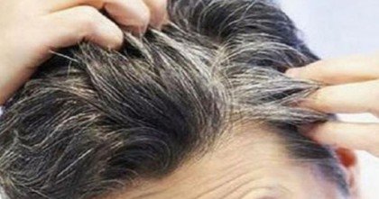 যেসব কারণে অল্প বয়সে চুল পেকে যায়!
